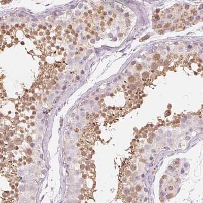 Immunohistochemistry: NUP210L Antibody [NBP2-49488]