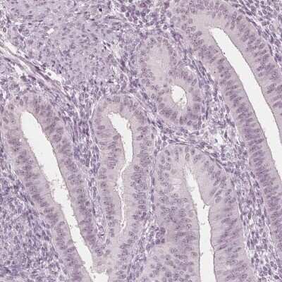 Immunohistochemistry-Paraffin: NUP210L Antibody [NBP2-49414]