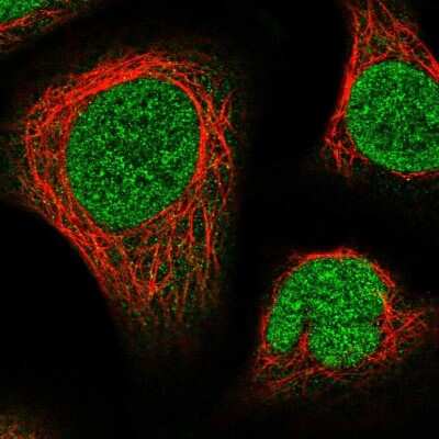 Immunocytochemistry/ Immunofluorescence: NUP214 Antibody [NBP2-58412]