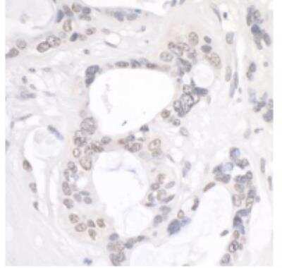 Immunohistochemistry-Paraffin: NUP214 Antibody [NB100-2244]