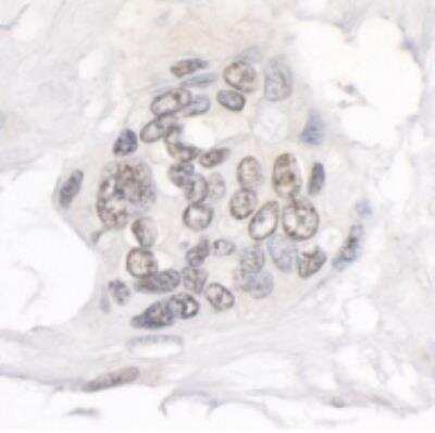Immunohistochemistry-Paraffin: NUP214 Antibody [NB100-2244]