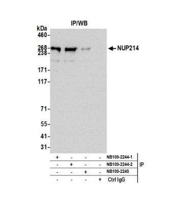 Immunoprecipitation: NUP214 Antibody [NB100-2244]