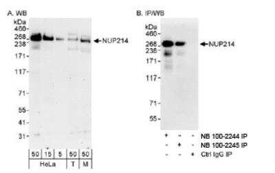 Western Blot: NUP214 Antibody [NB100-2245]