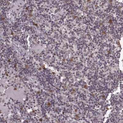 Immunohistochemistry-Paraffin: NUP37 Antibody [NBP2-58005]
