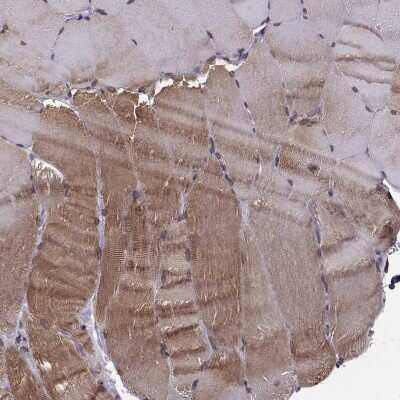 Immunohistochemistry-Paraffin: NUP37 Antibody [NBP2-58005]