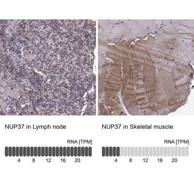 Immunohistochemistry-Paraffin: NUP37 Antibody [NBP2-58005]