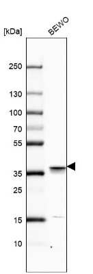Western Blot: NUP37 Antibody [NBP2-55454]