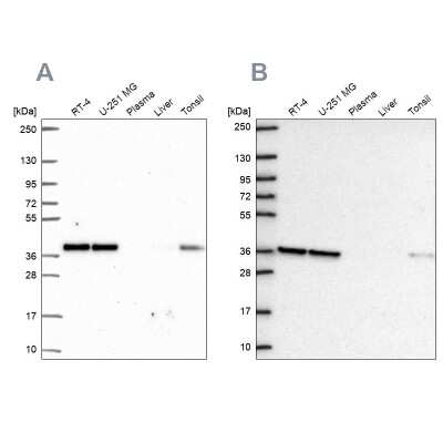 Western Blot: NUP37 Antibody [NBP2-55454]