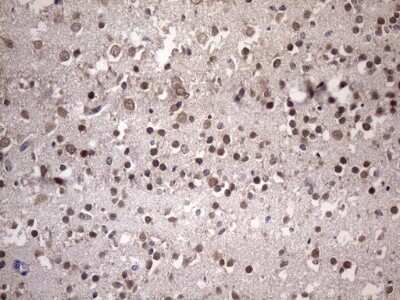 Immunohistochemistry: NUP43 Antibody (OTI6F8) [NBP2-46285]