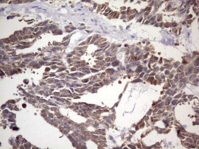 Immunohistochemistry: NUP43 Antibody (OTI6F8) [NBP2-46285]