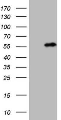 Western Blot: NUP43 Antibody (OTI6F8) [NBP2-46285]