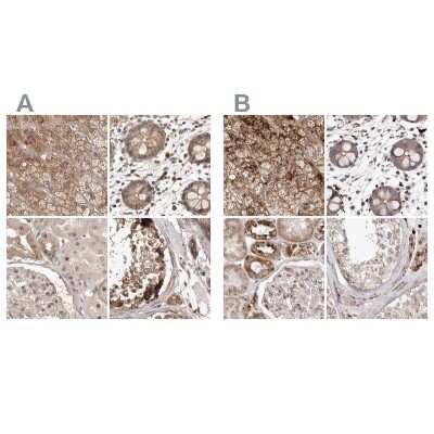 Immunohistochemistry-Paraffin: NUP43 Antibody [NBP1-88791]