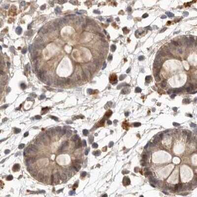 Immunohistochemistry-Paraffin: NUP43 Antibody [NBP1-88791]
