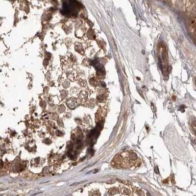 Immunohistochemistry-Paraffin: NUP43 Antibody [NBP1-88791]