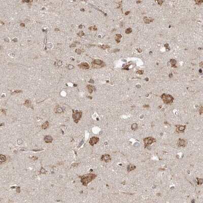 Immunohistochemistry-Paraffin: NUP43 Antibody [NBP1-88792]