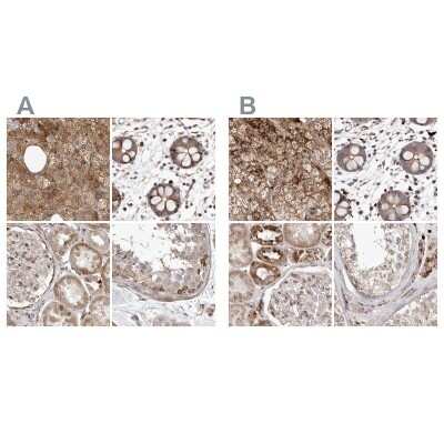 Immunohistochemistry-Paraffin: NUP43 Antibody [NBP1-88792]