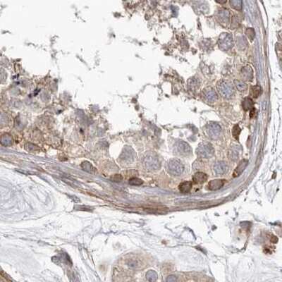 Immunohistochemistry-Paraffin: NUP43 Antibody [NBP1-88792]