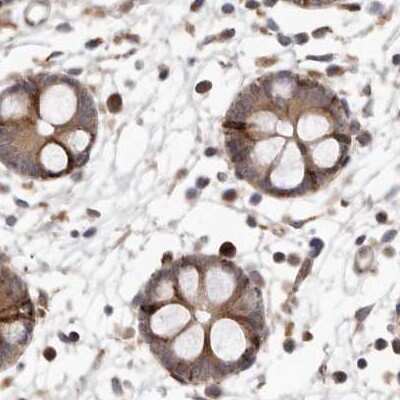 Immunohistochemistry-Paraffin: NUP43 Antibody [NBP1-88792]