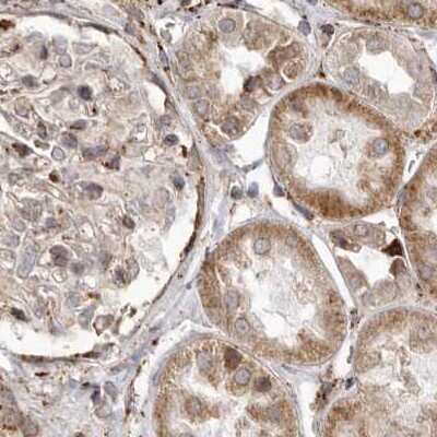 Immunohistochemistry-Paraffin: NUP43 Antibody [NBP1-88792]