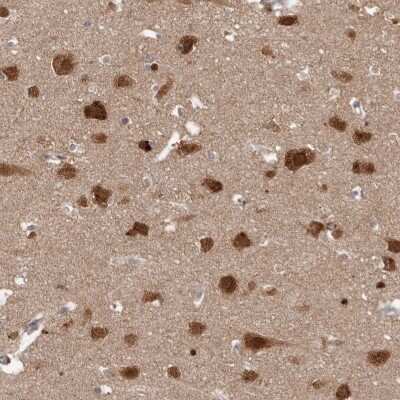 Immunohistochemistry-Paraffin: NUP43 Antibody [NBP1-88793]