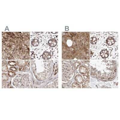 Immunohistochemistry-Paraffin: NUP43 Antibody [NBP1-88793]
