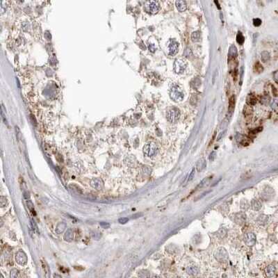 Immunohistochemistry-Paraffin: NUP43 Antibody [NBP1-88793]