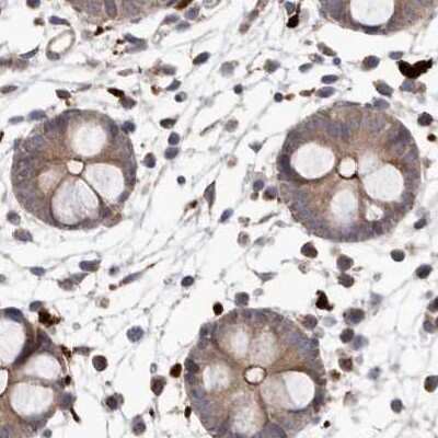 Immunohistochemistry-Paraffin: NUP43 Antibody [NBP1-88793]