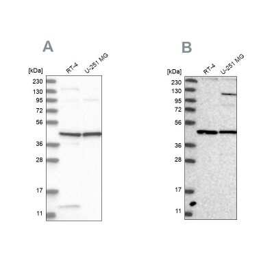 Western Blot: NUP43 Antibody [NBP1-88791]