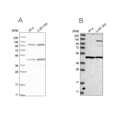 Western Blot: NUP43 Antibody [NBP1-88792]