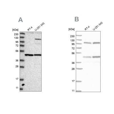 Western Blot: NUP43 Antibody [NBP1-88793]