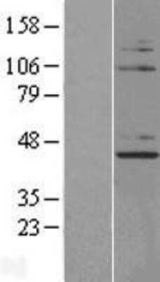 Western Blot: NUP43 Overexpression Lysate [NBL1-13876]