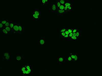 Immunocytochemistry/ Immunofluorescence: NUP50 Antibody [NBP2-97442]