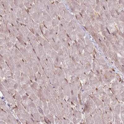 Immunohistochemistry-Paraffin: NUP50 Antibody [NBP2-13683]