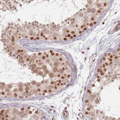 Immunohistochemistry-Paraffin: NUP50 Antibody [NBP2-13683]