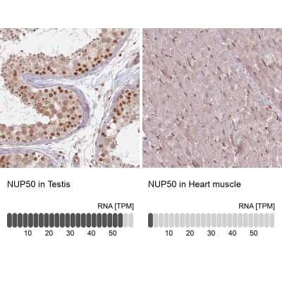Immunohistochemistry-Paraffin: NUP50 Antibody [NBP2-13683]