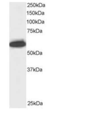 Western Blot: NUP50 Antibody [NB100-1212]