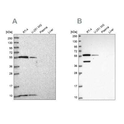 Western Blot: NUP50 Antibody [NBP2-13683]