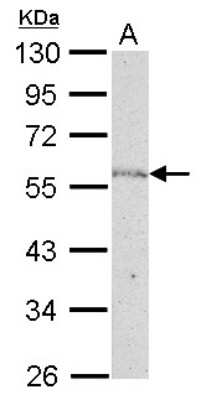 Western Blot: NUP50 Antibody [NBP2-19610]