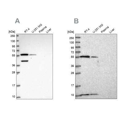 Western Blot: NUP50 Antibody [NBP2-57627]