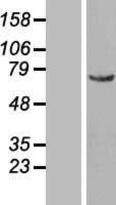 Western Blot: NUP50 Overexpression Lysate [NBL1-13878]