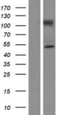 Western Blot: NUP50 Overexpression Lysate [NBP3-07978]