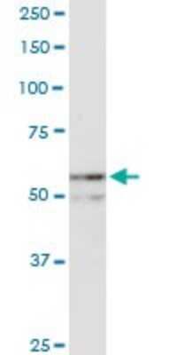 Western Blot: NUP54 Antibody [H00053371-D01P]