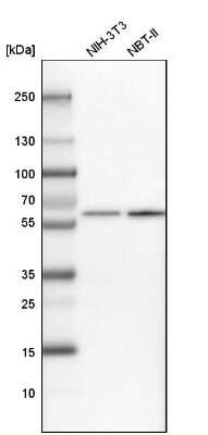 Western Blot: NUP54 Antibody [NBP1-85899]