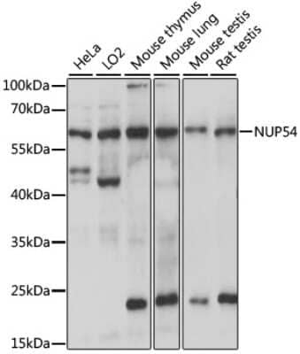 Western Blot: NUP54 AntibodyAzide and BSA Free [NBP2-94803]