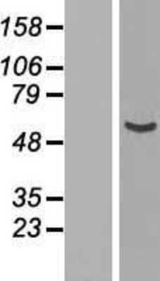 Western Blot: NUP54 Overexpression Lysate [NBP2-06983]