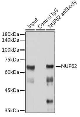 Immunoprecipitation: NUP62 Antibody (4V10S5) [NBP3-15729]