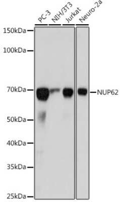 Western Blot: NUP62 Antibody (4V10S5) [NBP3-15729]