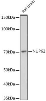 Western Blot: NUP62 Antibody (4V10S5) [NBP3-15729]