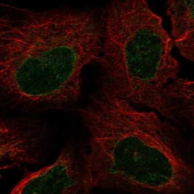 Immunocytochemistry/ Immunofluorescence: NUP62 Antibody [NBP1-85091]