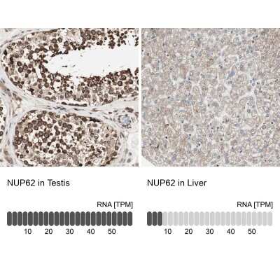 Immunohistochemistry-Paraffin: NUP62 Antibody [NBP1-85091]